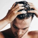 Men’s Hair Health Tips How Can You Save Your Hairline