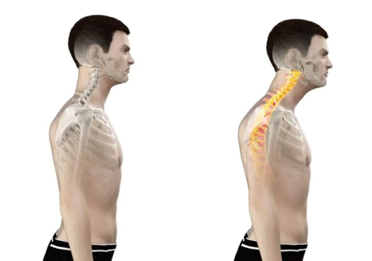 what is good posture?