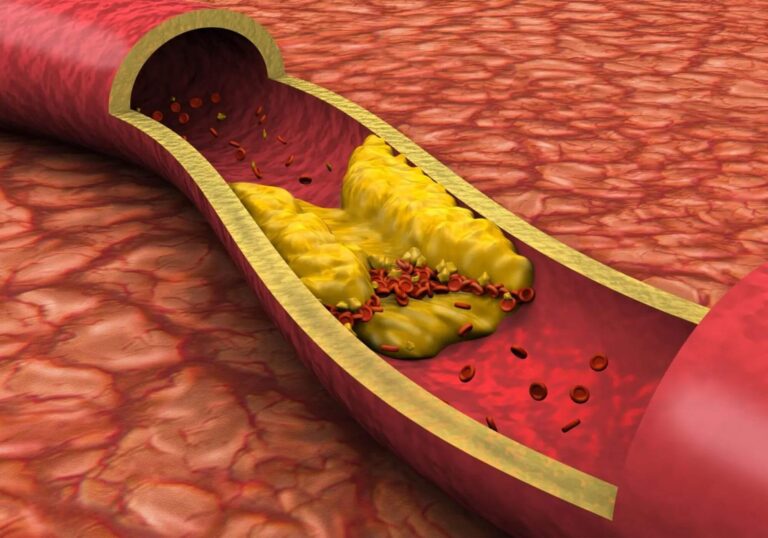 Men’s Sexual Health