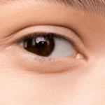 summer eye care